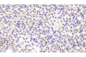 Immunohistochemistry (IHC) image for anti-Low Density Lipoprotein Receptor Adaptor Protein 1 (LDLRAP1) (AA 1-308) antibody (ABIN7440986)