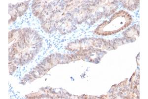 Immunohistochemistry (IHC) image for anti-Aldo-keto Reductase Family 1, Member C2 (AKR1C2) antibody (ABIN6939232)