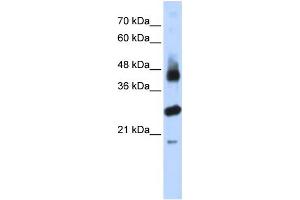 WB Suggested Anti-FBXL2 Antibody Titration:  0. (FBXL2 antibody  (N-Term))