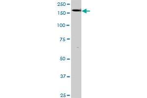 Western Blotting (WB) image for anti-TEK Tyrosine Kinase, Endothelial (TEK) (AA 66-185) antibody (ABIN793004) (TEK antibody  (AA 66-185))