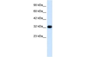 Western Blotting (WB) image for anti-Chromosome 22 Open Reading Frame 31 (C22orf31) antibody (ABIN2461056) (C22orf31 antibody)