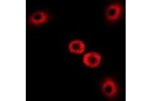 Immunofluorescent analysis of Myosin Ic staining in U2OS cells. (Myosin IC antibody)