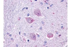 Immunohistochemical staining of Brain (Neurons and glia) using anti- CHRM4 antibody ABIN122327 (CHRM4 antibody)