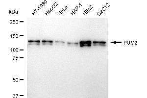Western blotting analysis using PUM2 antibody (ABIN7800065). (Recombinant PUM2 antibody)
