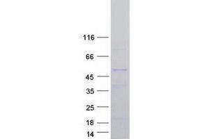 Validation with Western Blot (NOXO1 Protein (Transcript Variant C) (Myc-DYKDDDDK Tag))
