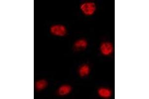 ABIN6275321 staining 293T by IF/ICC. (NCOA7 antibody  (Internal Region))