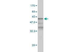 Western Blot detection against Immunogen (54. (KLF6 antibody  (AA 1-260))