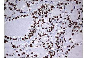 Image no. 1 for anti-Nibrin (NBN) (AA 183-460) antibody (ABIN1491059) (Nibrin antibody  (AA 183-460))