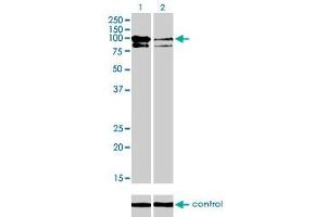 Western blot analysis of OCRL over-expressed 293 cell line, cotransfected with OCRL Validated Chimera RNAi (Lane 2) or non-transfected control (Lane 1). (OCRL antibody  (AA 146-239))