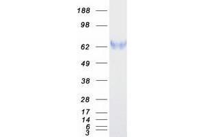 Western Blotting (WB) image for Ectonucleoside Triphosphate diphosphohydrolase 3 (ENTPD3) protein (Myc-DYKDDDDK Tag) (ABIN2713700)