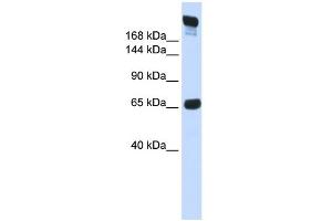 WB Suggested Anti-SI Antibody Titration:  0. (SI antibody  (N-Term))