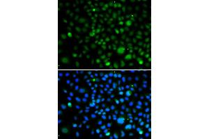 Immunofluorescence analysis of A549 cells using KLF15 antibody. (KLF15 antibody)