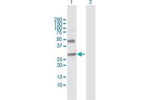 Western Blot analysis of NOG expression in transfected 293T cell line by NOG MaxPab polyclonal antibody. (NOG antibody  (AA 1-232))