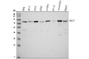 Western blot analysis of MUT using anti-MUT antibody (ABIN4886676). (MUT antibody  (N-Term))
