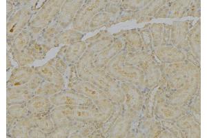ABIN6279587 at 1/100 staining Mouse kidney tissue by IHC-P. (MT-ND4L antibody)