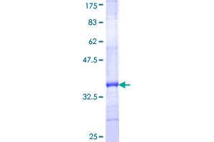 Image no. 1 for HLA Complex P5 (Non-Protein Coding) (HCP5) (AA 3-103) protein (GST tag) (ABIN1306435) (HCP5 Protein (AA 3-103) (GST tag))