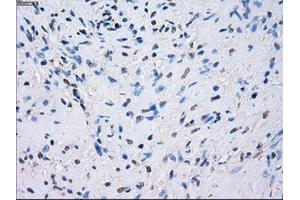 Immunohistochemical staining of paraffin-embedded prostate tissue using anti-FCGR2A mouse monoclonal antibody. (FCGR2A antibody)