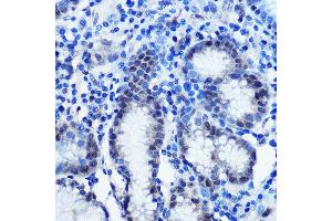 Immunohistochemistry of paraffin-embedded human stomach using BRD4 Rabbit pAb (ABIN7265946) at dilution of 1:100 (40x lens). (BRD4 antibody  (AA 700-794))