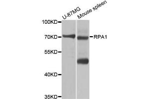 Western blot analysis of extracts of various cell lines, using RPA1 antibody (ABIN5970378) at 1/1000 dilution. (RPA1 antibody)