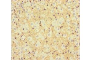 Immunohistochemistry of paraffin-embedded human adrenal gland tissue using ABIN7157290 at dilution of 1:100 (KLHL3 antibody  (AA 1-301))