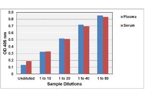 Biochemical Assay (BCA) image for OxiSelect™ Trolox Equivalent Antioxidant Capacity (TEAC) Assay Kit (ABTS) (ABIN5067625)