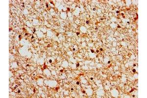 Immunohistochemistry of paraffin-embedded human brain tissue using ABIN7169471 at dilution of 1:100