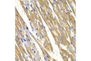 Immunohistochemistry of paraffin-embedded rat heart using TYR antibody at dilution of 1:100 (400x lens). (TYR antibody)