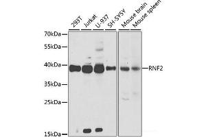 Western blot analysis of extracts of various cell lines using RNF2 Polyclonal Antibody at dilution of 1:1000. (RNF2 antibody)