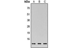 Western blot analysis of C35 expression in MCF7 (A), NS-1 (B), PC12 (C) whole cell lysates. (C17orf37 antibody  (C-Term))