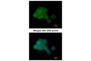 ICC/IF Image Immunofluorescence analysis of paraformaldehyde-fixed A431, using eEF-2K, antibody at 1:200 dilution. (EEF2K antibody  (N-Term))