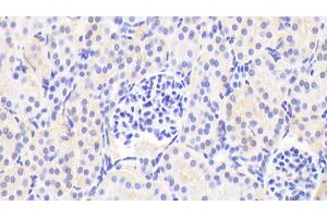 Detection of APOD in Human Kidney Tissue using Polyclonal Antibody to Apolipoprotein D (APOD) (Apolipoprotein D antibody  (AA 21-189))