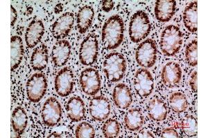 CACYBP antibody  (C-Term)