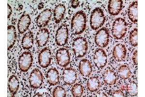 Immunohistochemistry (IHC) analysis of paraffin-embedded Human Colon, antibody was diluted at 1:100. (CACYBP antibody  (C-Term))