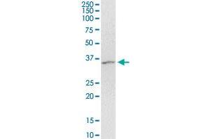 Western Blotting (WB) image for anti-Arrestin, beta 2 (ARRB2) (AA 300-409) antibody (ABIN513515)