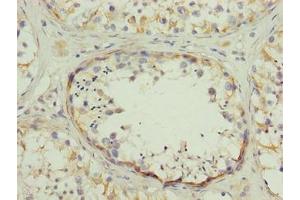 Immunohistochemistry of paraffin-embedded human testis tissue using ABIN7170536 at dilution of 1:100 (SPZ1 antibody  (AA 181-430))