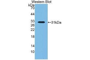 Detection of Recombinant LBP, Bovine using Polyclonal Antibody to Lipopolysaccharide Binding Protein (LBP) (LBP antibody  (AA 224-468))
