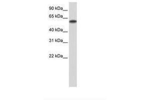 Image no. 3 for anti-Zinc Finger Protein 394 (ZNF394) (N-Term) antibody (ABIN6736210) (ZNF394 antibody  (N-Term))