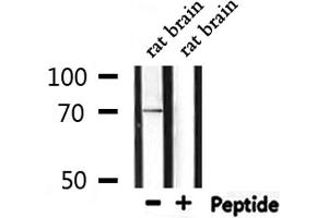 Western blot analysis of extracts from rat brain, using PROS1 Antibody. (PROS1 antibody  (N-Term))