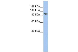 Western Blotting (WB) image for anti-Ring Finger Protein 20 (RNF20) antibody (ABIN2458728) (RNF20 antibody)