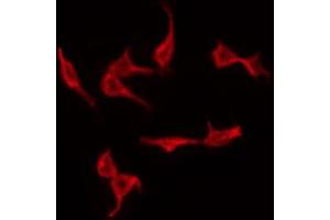ABIN6267293 staining MDA-MB-435 by IF/ICC. (p53 antibody  (pSer315))