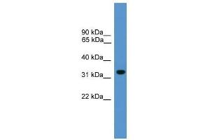 Western Blot showing BNIP1 antibody used at a concentration of 1-2 ug/ml to detect its target protein. (BNIP1 antibody  (N-Term))