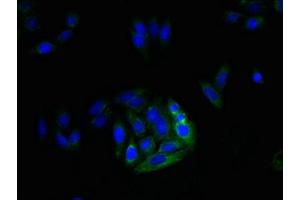 Immunofluorescent analysis of HepG2 cells using ABIN7159017 at dilution of 1:100 and Alexa Fluor 488-congugated AffiniPure Goat Anti-Rabbit IgG(H+L) (MRGPRX3 antibody  (AA 276-322))