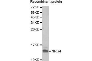 Western blot analysis of extracts of Recombinant protein, using NRG4 antibody. (Neuregulin 4 antibody  (AA 1-115))