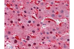 Human Liver: Formalin-Fixed, Paraffin-Embedded (FFPE) (Isocitrate Dehydrogenase antibody)