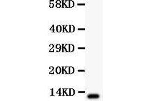 Observed bind size: 12KD (TFF1 antibody  (AA 25-84))