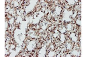 Immunostaining (ISt) image for anti-Mitogen-Activated Protein Kinase 9 (MAPK9) (AA 1-424) antibody (ABIN562412)