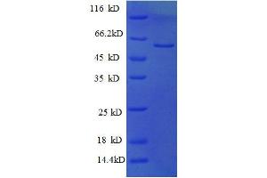 SDS-PAGE (SDS) image for Protein Kinase C Substrate 80K-H (PRKCSH) (AA 15-302), (partial) protein (GST tag) (ABIN1047075)