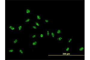 Immunofluorescence of purified MaxPab antibody to ZNF593 on HeLa cell. (ZNF593 antibody  (AA 1-116))