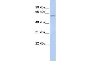 WB Suggested Anti-C6orf182 Antibody Titration: 0. (CEP57L1 antibody  (Middle Region))