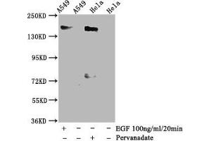 Western Blot Positive WB detected in A549 whole cell lysate,Hela whole cell lysate(treated with Pervanadate or EGF) All lanes Phospho-EGFR antibody at 1. (Recombinant EGFR antibody  (pTyr1092))